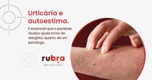 urticaria-e-autoestima