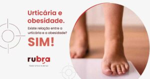 urticaria-e-obesidade