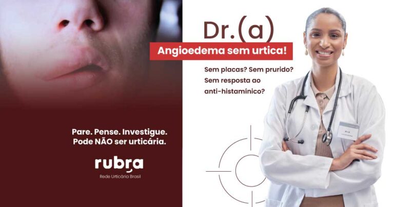 ANGIOEDEMA-SEM-URTICA