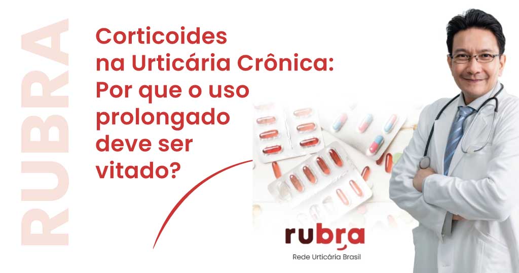 corticoidas-urticaria-cronica